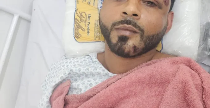 Segurança de Rabicó é Preso em Hospital de São Gonçalo Após Acidente de Moto e Uso de Nome Falso
