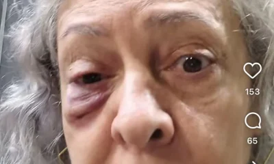 Artista de 62 anos é agredida com soco no rosto enquanto cantava louvor no Catete, Zona Sul do Rio