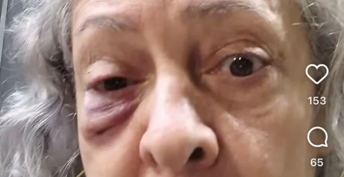 Artista de 62 anos é agredida com soco no rosto enquanto cantava louvor no Catete, Zona Sul do Rio