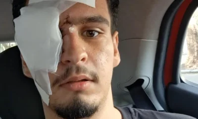 Meu maior sonho é voltar a enxergar, diz jovem atingido por bala de borracha após clássico no Maracanã