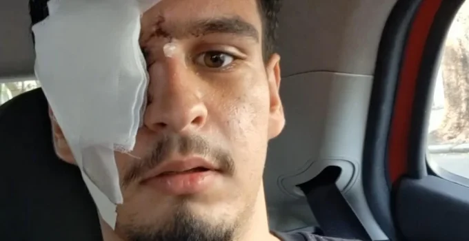 Meu maior sonho é voltar a enxergar, diz jovem atingido por bala de borracha após clássico no Maracanã