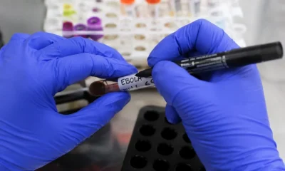Especialistas Afastam Risco de Pandemia de Ebola; Entenda os Motivos e a Transmissão da Doença