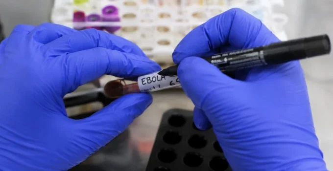 Especialistas Afastam Risco de Pandemia de Ebola; Entenda os Motivos e a Transmissão da Doença