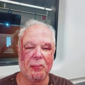 Militante do PT é agredido em Copacabana após uso de adesivo de Benedita da Silva; bancada petista reage