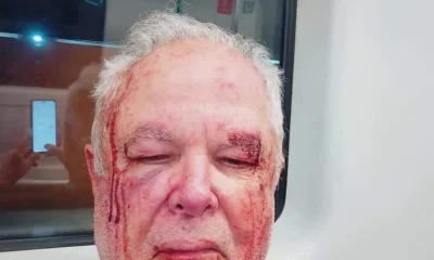 Militante do PT é agredido em Copacabana após uso de adesivo de Benedita da Silva; bancada petista reage