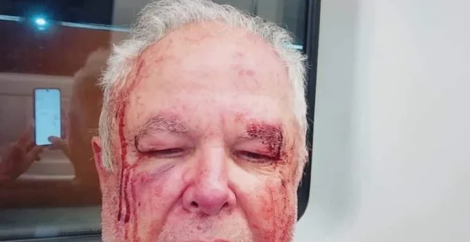 Militante do PT é agredido em Copacabana após uso de adesivo de Benedita da Silva; bancada petista reage