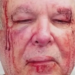 Idoso é agredido em Copacabana; Polícia Civil investiga motivação política e religiosa do ataque