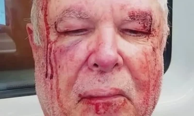 Idoso é agredido em Copacabana; Polícia Civil investiga motivação política e religiosa do ataque