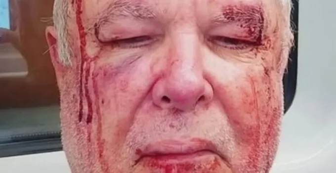 Idoso é agredido em Copacabana; Polícia Civil investiga motivação política e religiosa do ataque