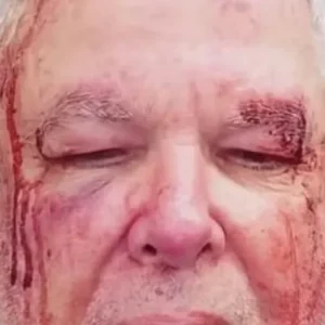 Idoso agredido no Rio só fez perícia após ir à Corregedoria da Polícia Civil