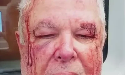 Idoso agredido no Rio só fez perícia após ir à Corregedoria da Polícia Civil