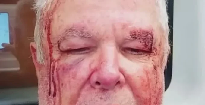 Idoso agredido no Rio só fez perícia após ir à Corregedoria da Polícia Civil