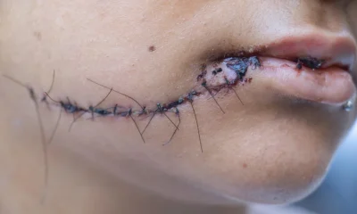 Mulher é atacada com estilete por ex-companheiro em Vila Valqueire; mãe intervém
