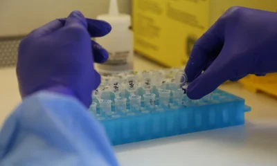 Rio de Janeiro registra 11 casos de Mpox em 2026, com queda significativa em relação aos anos anteriores