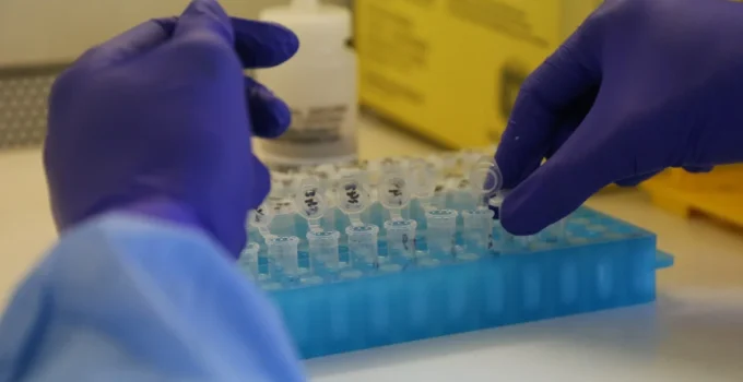 Rio de Janeiro registra 11 casos de Mpox em 2026, com queda significativa em relação aos anos anteriores