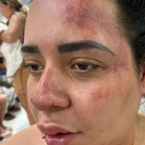 Mulher denuncia ex-companheiro por tentativa de feminicídio e roubo em São Gonçalo: 'Ele pode me matar'