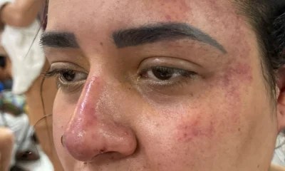 Mulher denuncia ex-companheiro por tentativa de feminicídio e roubo em São Gonçalo: 'Ele pode me matar'