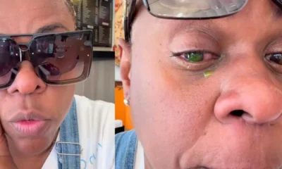 Alerta no Rio: Pomadas Capilares Podem Causar Cegueira Temporária; Atriz Cacau Protásio Relata Perda de Visão
