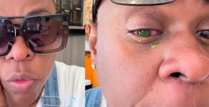 Alerta no Rio: Pomadas Capilares Podem Causar Cegueira Temporária; Atriz Cacau Protásio Relata Perda de Visão